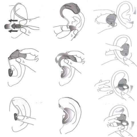 Sposoby prawidłowego zakładania i pielęgnacja aparatów słuchowych