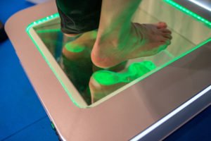 Płaskostopie poprzeczne - jakie są objawy i jak wygląda leczenie? - brandvital.eu