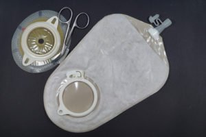 Urostomię wyłania się w sytuacji poważnego urazu lub choroby dróg moczowych