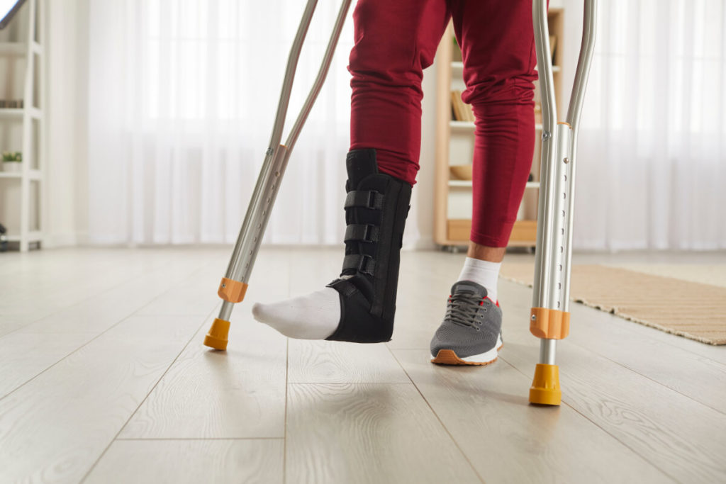 Złamana noga – leczenie, rehabilitacja i pomocne wyroby medyczne
